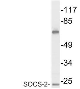 Western blot analysis of lysate from Jurkat cells using Anti-SOCS-2 Antibody