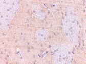 Anti-GPAM Rabbit Polyclonal Antibody