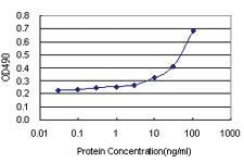 Anti-TGM1 Polyclonal Antibody Pair