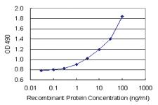 Anti-SAE1 Antibody Pair