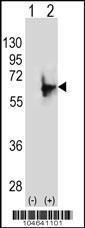 Anti-NMT2 Rabbit Polyclonal Antibody (AP (Alkaline Phosphatase))