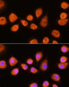 Immunofluorescence analysis of L929 cells using Anti-ASPM Antibody (A306282) at a dilution of 1:100 DAPI was used to stain the cell nuclei (blue)