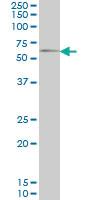 Anti-GGT1 Mouse Monoclonal Antibody [clone: 1F9]