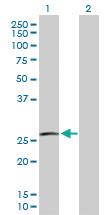 Anti-RAC3 Rabbit Polyclonal Antibody