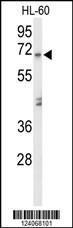 Anti-AMY1A Rabbit Polyclonal Antibody (AP (Alkaline Phosphatase))