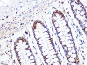 Anti-ACADM/MCAD Rabbit Monoclonal Antibody [clone: ARC1035]