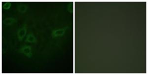 Immunofluorescence analysis of HepG2 cells using Anti-TK Antibody. The right hand panel represents a negative control, where the antibody was pre-incubated with the immunising peptide