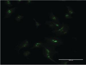 Anti-MSX1 Mouse Monoclonal Antibody [clone: 1E2]