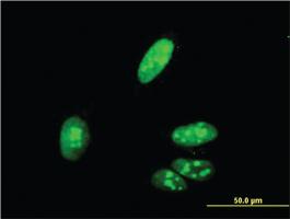 Anti-ZIC4 Mouse Monoclonal Antibody [clone: 3A2]