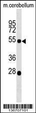 Anti-KCNJ12 Rabbit Polyclonal Antibody (Biotin)