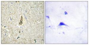 Immunohistochemical analysis of paraffin-embedded human brain using Anti-Cytochrome P450 26C1 Antibody. The right hand panel represents a negative control, where the Antibody was pre-incubated with the immunising peptide