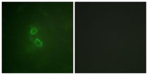 Immunofluorescence analysis of COS7 cells using Anti-CD227 Antibody. The right hand panel represents a negative control, where the antibody was pre-incubated with the immunising peptide.