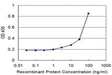 Anti-AIMP1 Mouse Monoclonal Antibody [clone: 3H5]