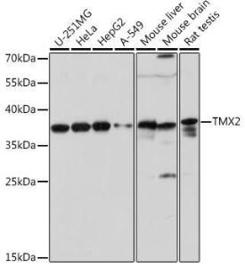 Western blot analysis of extracts of various cell lines, using Anti-TMX2 Antibody (A93341) at 1:1,000 dilution. The secondary antibody was Goat Anti-Rabbit IgG H&L Antibody (HRP) at 1:10,000 dilution.