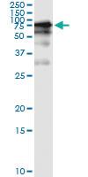 Anti-GGT1 Mouse Monoclonal Antibody [clone: 1F9]