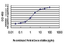 Anti-ZIC4 Mouse Monoclonal Antibody [clone: 3A2]