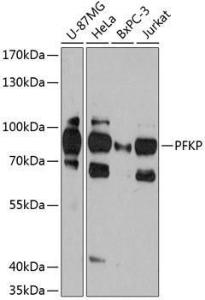 Western blot analysis of extracts of various cell lines, using Anti-PFKP Antibody (A306283) at 1:3,000 dilution The secondary antibody was Goat Anti-Rabbit IgG H&L Antibody (HRP) at 1:10,000 dilution Lysates/proteins were present at 25 µg per lane