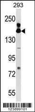 Anti-FANCA Rabbit Polyclonal Antibody