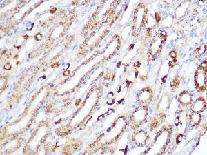 Anti-ACADM/MCAD Rabbit Monoclonal Antibody [clone: ARC1035]