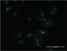 Anti-MSX1 Mouse Monoclonal Antibody [clone: 1E2]