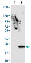 Anti-FAM162B Rabbit Polyclonal Antibody