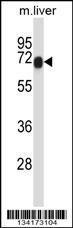 Anti-HIPK4 Rabbit Polyclonal Antibody (Biotin)