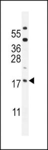 Anti-ORMDL3 Rabbit Polyclonal Antibody