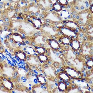 Immunohistochemistry analysis of paraffin-embedded mouse kidney using Anti-TMX2 Antibody (A93341) at a dilution of 1:100 (40x lens). Perform microwave antigen retrieval with 10 mM Tris/EDTA buffer pH 9.0 before commencing with IHC staining protocol.