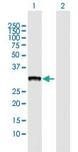 Anti-CBR3 Rabbit Polyclonal Antibody