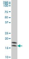 Anti-NME2 Mouse Monoclonal Antibody [clone: 1D3]