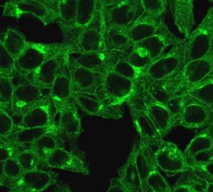 Anti-beta 2 Microglobulin antibody