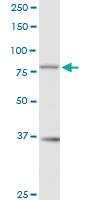 Anti-RAD17 Rabbit Polyclonal Antibody