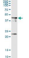 Anti-CENPJ Mouse Monoclonal Antibody [clone: 1A5]