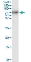 Anti-MAPKAPK5 Polyclonal Antibody Pair