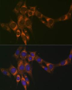 Anti-ACADM/MCAD Rabbit Monoclonal Antibody [clone: ARC1035]