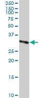 Anti-CBR3 Rabbit Polyclonal Antibody