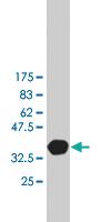 Anti-PTCH1 Mouse Monoclonal Antibody [clone: 1B7]