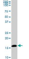 Anti-NME2 Mouse Monoclonal Antibody [clone: 1D3]