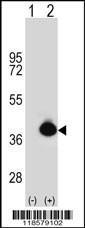 Anti-DNA Polymerase delta Interacting Protein p38 Rabbit Polyclonal Antibody