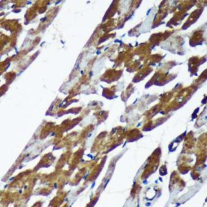 Immunohistochemistry analysis of paraffin-embedded rat heart using Anti-TMX2 Antibody (A93341) at a dilution of 1:100 (40x lens). Perform microwave antigen retrieval with 10 mM Tris/EDTA buffer pH 9.0 before commencing with IHC staining protocol.