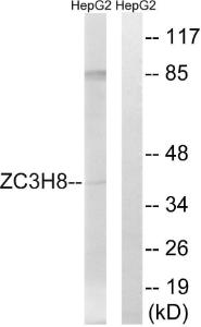 Western blot analysis of lysates from HepG2 cells using Anti-ZC3H8 Antibody. The right hand lane represents a negative control, where the antibody is blocked by the immunising peptide.