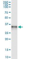 Anti-CBR3 Rabbit Polyclonal Antibody