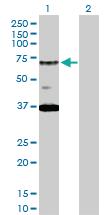 Anti-RAD17 Rabbit Polyclonal Antibody