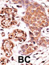 Anti-ABL2 Rabbit Polyclonal Antibody (Biotin)