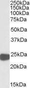 Anti-PRDX1 Antibody (A83660) (0.01 µg/ml) staining of HepG2 lysate (35 µg protein in RIPA buffer). Primary incubation was 1 hour. Detected by chemiluminescence