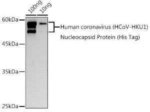 Anti-Human Coronovirus Nucleoprotein Rabbit Polyclonal Antibody