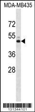 Anti-KCNJ13 Rabbit Polyclonal Antibody (AP (Alkaline Phosphatase))