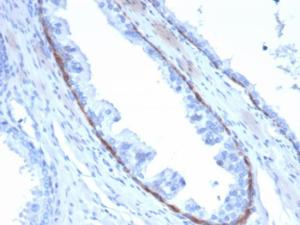 Immunohistochemical analysis of formalin-fixed, paraffin-embedded human prostate tissue using Anti-Cytokeratin 14 Antibody [KRT14/4132]