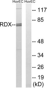 Western blot analysis of lysates from HUVEC cells using Anti-RDX Antibody. The right hand lane represents a negative control, where the antibody is blocked by the immunising peptide.