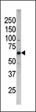 Anti-FOXE3 Rabbit Polyclonal Antibody